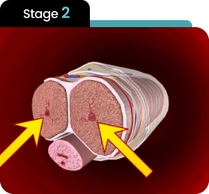 Stage 2 diagram showing blood flowing directly into the penile tissue chambers and expanding the vessels.